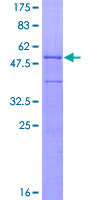 C1QTNF6 / CTRP6 Protein - 12.5% SDS-PAGE of human C1QTNF6 stained with Coomassie Blue