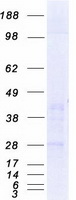 C1QTNF6 / CTRP6 Protein - Purified recombinant protein C1QTNF6 was analyzed by SDS-PAGE gel and Coomassie Blue Staining