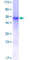 C1QTNF7 / CTRP7 Protein - 12.5% SDS-PAGE of human C1QTNF7 stained with Coomassie Blue