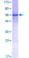 C1QTNF9 Protein - 12.5% SDS-PAGE of human MGC48915 stained with Coomassie Blue