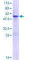 C20orf11 / TWA1 Protein - 12.5% SDS-PAGE of human C20orf11 stained with Coomassie Blue
