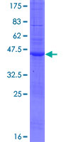 C20orf141 Protein - 12.5% SDS-PAGE of human C20orf141 stained with Coomassie Blue