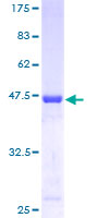 C20orf27 Protein - 12.5% SDS-PAGE of human C20orf27 stained with Coomassie Blue