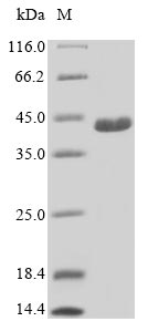 C21orf2 Protein - (Tris-Glycine gel) Discontinuous SDS-PAGE (reduced) with 5% enrichment gel and 15% separation gel.