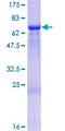 C21orf2 Protein - 12.5% SDS-PAGE of human C21orf2 stained with Coomassie Blue