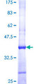 C21orf2 Protein - 12.5% SDS-PAGE Stained with Coomassie Blue.