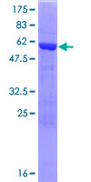 C21orf59 Protein - 12.5% SDS-PAGE of human C21orf59 stained with Coomassie Blue