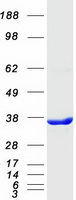 C21orf59 Protein - Purified recombinant protein C21orf59 was analyzed by SDS-PAGE gel and Coomassie Blue Staining