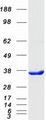 C21orf59 Protein - Purified recombinant protein C21orf59 was analyzed by SDS-PAGE gel and Coomassie Blue Staining