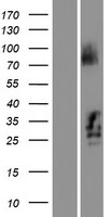 C21orf62 Protein - Western validation with an anti-DDK antibody * L: Control HEK293 lysate R: Over-expression lysate