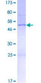C22orf23 Protein - 12.5% SDS-PAGE of human C22orf23 stained with Coomassie Blue