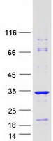 C22orf23 Protein - Purified recombinant protein C22orf23 was analyzed by SDS-PAGE gel and Coomassie Blue Staining