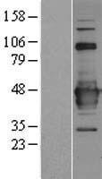 C22orf29 Protein - Western validation with an anti-DDK antibody * L: Control HEK293 lysate R: Over-expression lysate