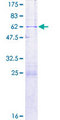C22orf31 Protein - 12.5% SDS-PAGE of human C22orf31 stained with Coomassie Blue