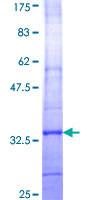 C25H / CH25H Protein - 12.5% SDS-PAGE Stained with Coomassie Blue.