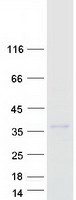 C25H / CH25H Protein - Purified recombinant protein CH25H was analyzed by SDS-PAGE gel and Coomassie Blue Staining
