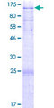 C2CD2L / TMEM24 Protein - 12.5% SDS-PAGE of human TMEM24 stained with Coomassie Blue