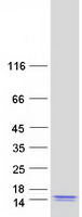 C2orf15 Protein - Purified recombinant protein C2orf15 was analyzed by SDS-PAGE gel and Coomassie Blue Staining