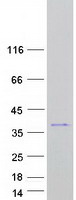 C2orf27A / C2orf27 Protein - Purified recombinant protein C2orf27A was analyzed by SDS-PAGE gel and Coomassie Blue Staining