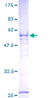 C2orf47 Protein - 12.5% SDS-PAGE of human FLJ22555 stained with Coomassie Blue