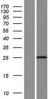 C2orf61 Protein - Western validation with an anti-DDK antibody * L: Control HEK293 lysate R: Over-expression lysate