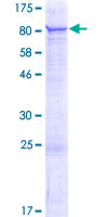C2orf63 Protein - 12.5% SDS-PAGE of human C2orf63 stained with Coomassie Blue