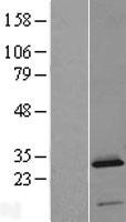 C2orf88 Protein - Western validation with an anti-DDK antibody * L: Control HEK293 lysate R: Over-expression lysate