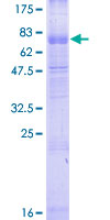 C3AR / C3a Receptor Protein - 12.5% SDS-PAGE of human C3AR1 stained with Coomassie Blue