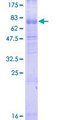 C3AR / C3a Receptor Protein - 12.5% SDS-PAGE of human C3AR1 stained with Coomassie Blue