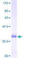 C3orf10 Protein - 12.5% SDS-PAGE of human C3orf10 stained with Coomassie Blue