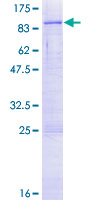 C3orf17 / NET17 Protein - 12.5% SDS-PAGE of human C3orf17 stained with Coomassie Blue