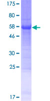 C3orf70 Protein - 12.5% SDS-PAGE of human LOC285382 stained with Coomassie Blue