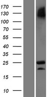 C3orf84 Protein - Western validation with an anti-DDK antibody * L: Control HEK293 lysate R: Over-expression lysate