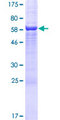 C4.4A / LYPD3 Protein - 12.5% SDS-PAGE of human LYPD3 stained with Coomassie Blue