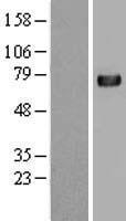 C4BPA / C4BP Alpha Protein - Western validation with an anti-DDK antibody * L: Control HEK293 lysate R: Over-expression lysate