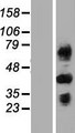 C4BPB / C4BP Beta Protein - Western validation with an anti-DDK antibody * L: Control HEK293 lysate R: Over-expression lysate