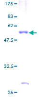 C4BPB / C4BP Beta Protein - 12.5% SDS-PAGE of human C4BPB stained with Coomassie Blue