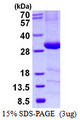 C4BPB / C4BP Beta Protein