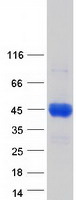 C4BPB / C4BP Beta Protein - Purified recombinant protein C4BPB was analyzed by SDS-PAGE gel and Coomassie Blue Staining
