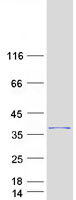 C4orf22 Protein - Purified recombinant protein C4orf22 was analyzed by SDS-PAGE gel and Coomassie Blue Staining