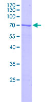 C4orf49 / OSAP Protein - 12.5% SDS-PAGE of human C4orf49 stained with Coomassie Blue