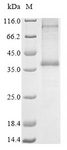C5AR2 / GPR77 / C5L2 Protein - (Tris-Glycine gel) Discontinuous SDS-PAGE (reduced) with 5% enrichment gel and 15% separation gel.