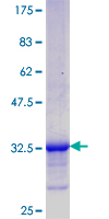 C5orf13 Protein - 12.5% SDS-PAGE Stained with Coomassie Blue.