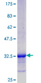C5orf13 Protein - 12.5% SDS-PAGE Stained with Coomassie Blue.