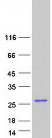 C5orf24 Protein - Purified recombinant protein C5orf24 was analyzed by SDS-PAGE gel and Coomassie Blue Staining