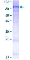 C5orf34 Protein - 12.5% SDS-PAGE of human C5orf34 stained with Coomassie Blue