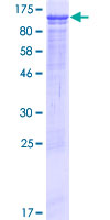 C5orf41 Protein - 12.5% SDS-PAGE of human C5orf41 stained with Coomassie Blue