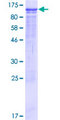 C5orf41 Protein - 12.5% SDS-PAGE of human C5orf41 stained with Coomassie Blue