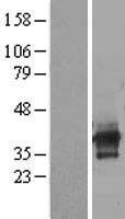 C6orf106 Protein - Western validation with an anti-DDK antibody * L: Control HEK293 lysate R: Over-expression lysate