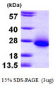 C6orf108 Protein